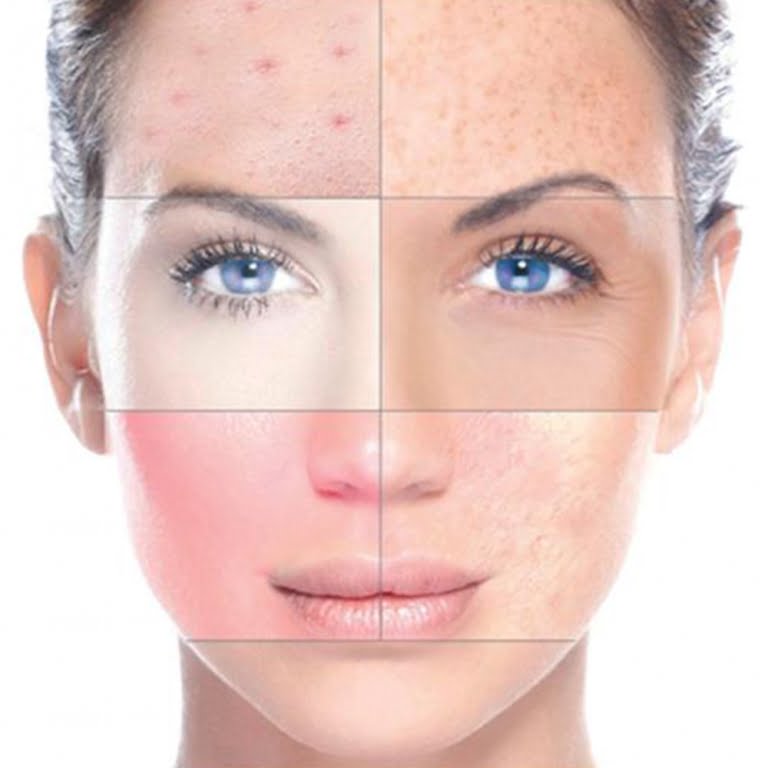 تشخیص-نوع-پوست