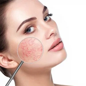 برنامه روزانه مراقبت از پوست حساس