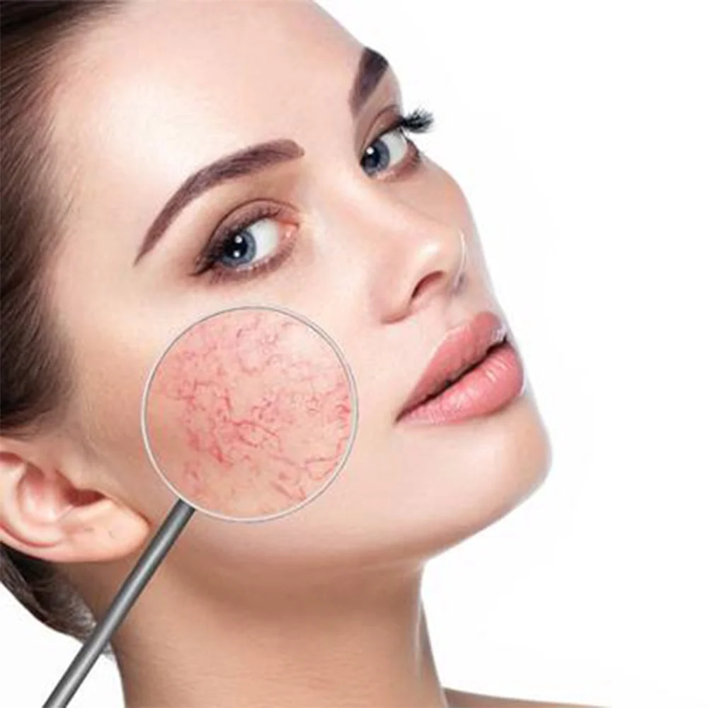 برنامه روزانه مراقبت از پوست حساس
