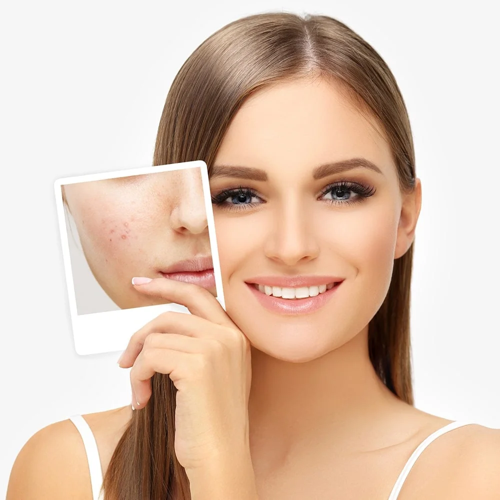 ۵ راهکار شفاف کردن پوست