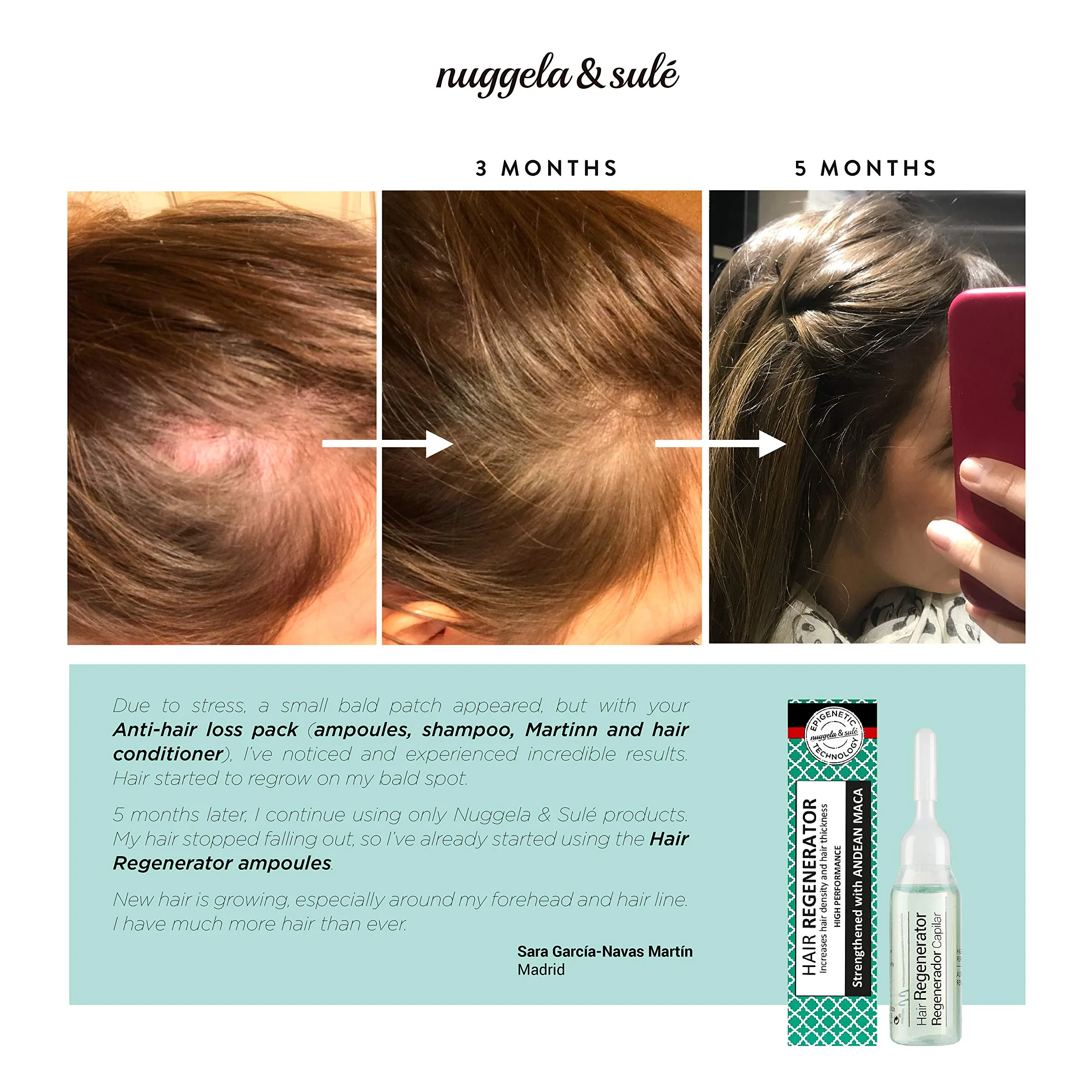 سرم افزایش ضخامت و رشد مجدد و افزایش سرعت رشد مو و ابرو نوگلا (10ml) Nuggela & Sule Regenerate Serum - تصویر 2