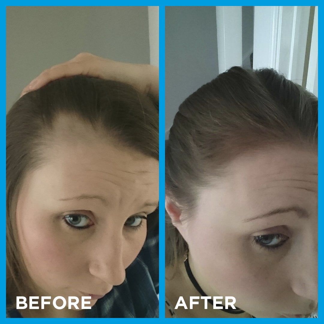 قرص ضد ریزش 3ماهه نورکرین Nourkrin hair growth مخصوص بانوان (ورق 30 عددی ) - تصویر 3