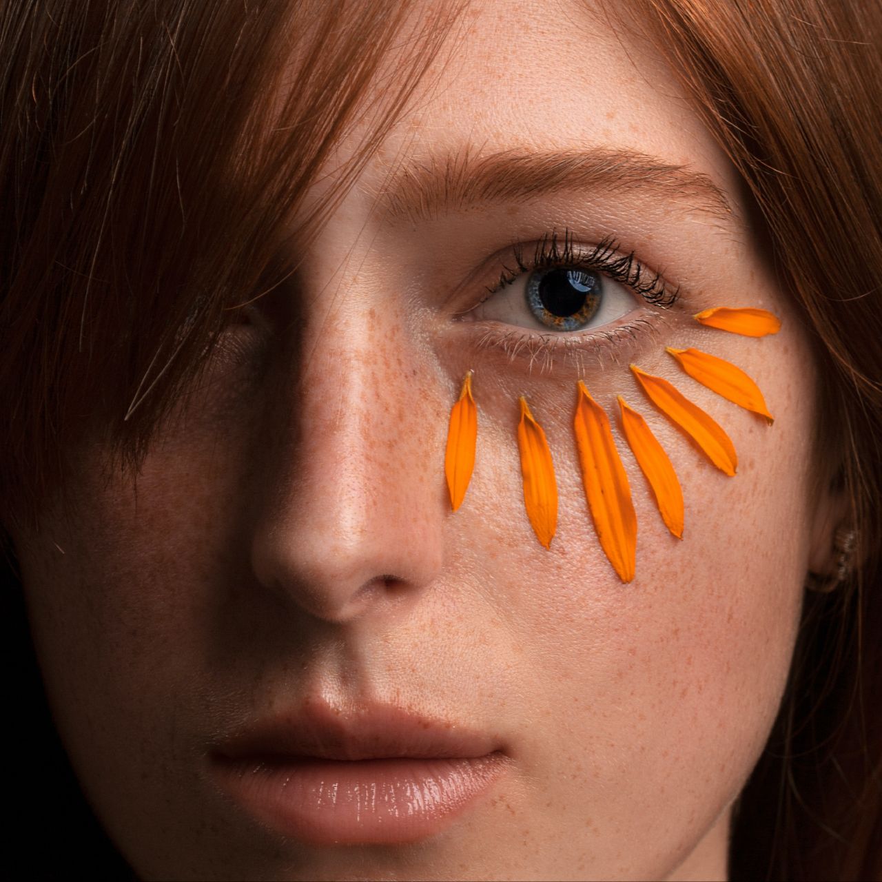 تیرگی دور چشم