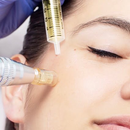 بهترین کوکتل مزوتراپی