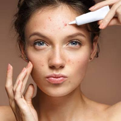 از بین بردن لک صورت