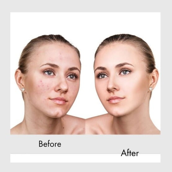 خرید قرص گلوتاتیون خارجی