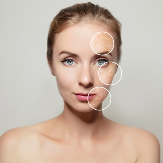 قویترین ضد لک گیاهی