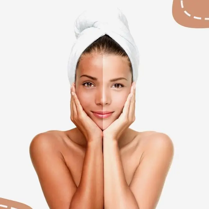 گلوتاتیون برای سفیدی پوست