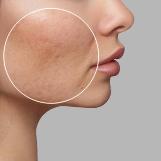 انواع منافذ باز پوست