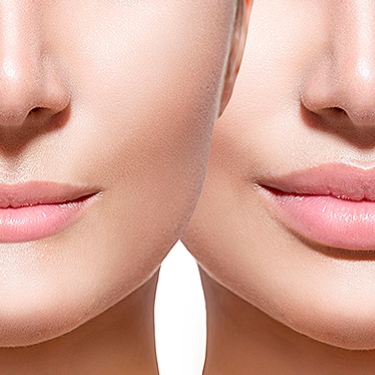 آیا والوفیلین میتواند لبها و گونههای شما را بهطور طبیعی پرتر کند؟ کشف راز زیبایی بدون هیچ تزریقی!