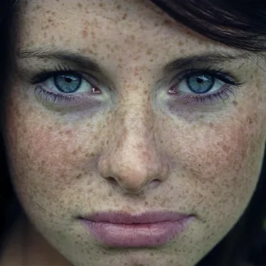 اهمیت ماسک ویتامین E- راهنمای جامع