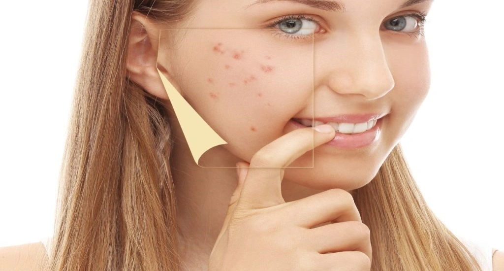 ترانگزامیک اسید