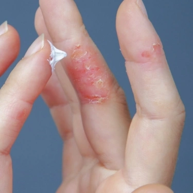 ترمیم کننده