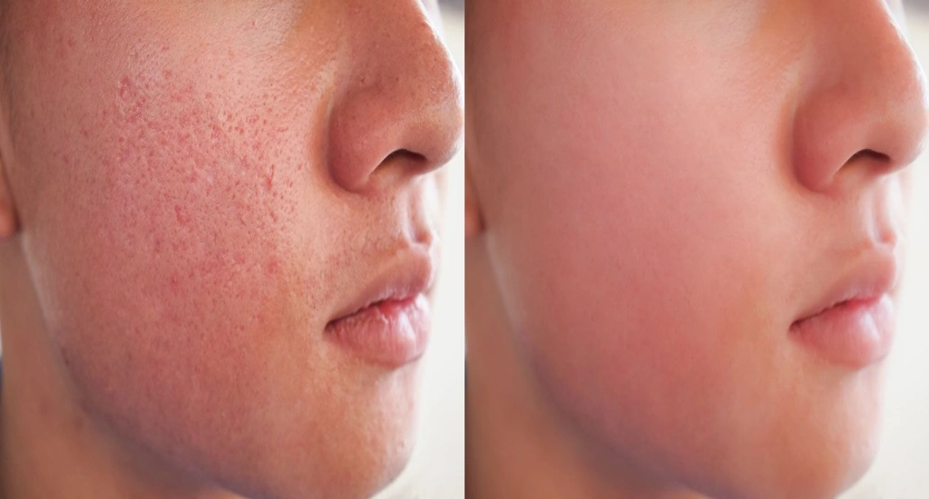 منافذ باز پوست