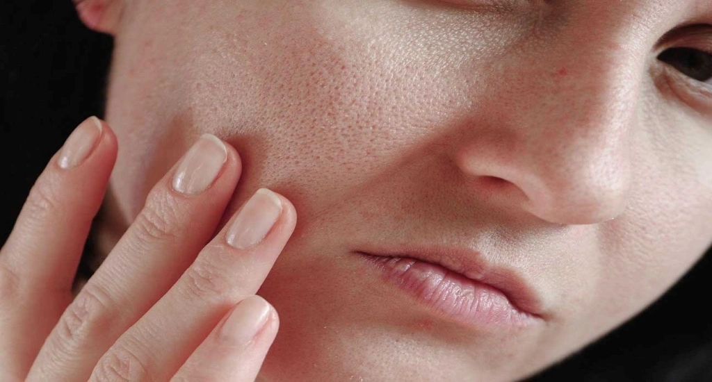 درمان منافذ باز