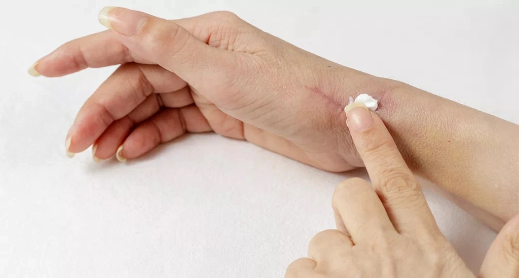 کرم ترمیم کننده بدون جوش