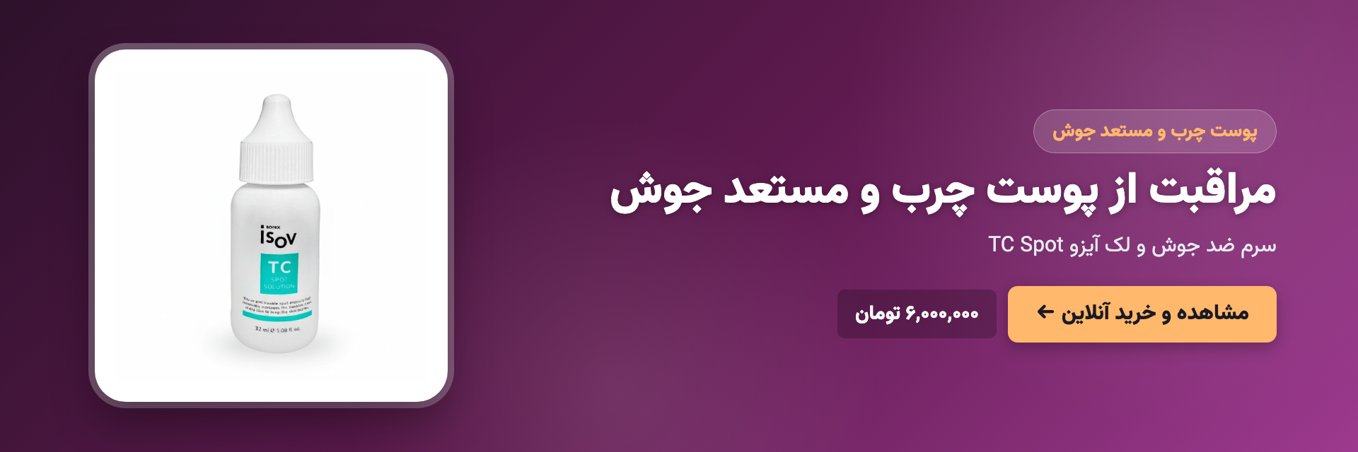 مراقبت از پوست چرب و مستعد جوش
